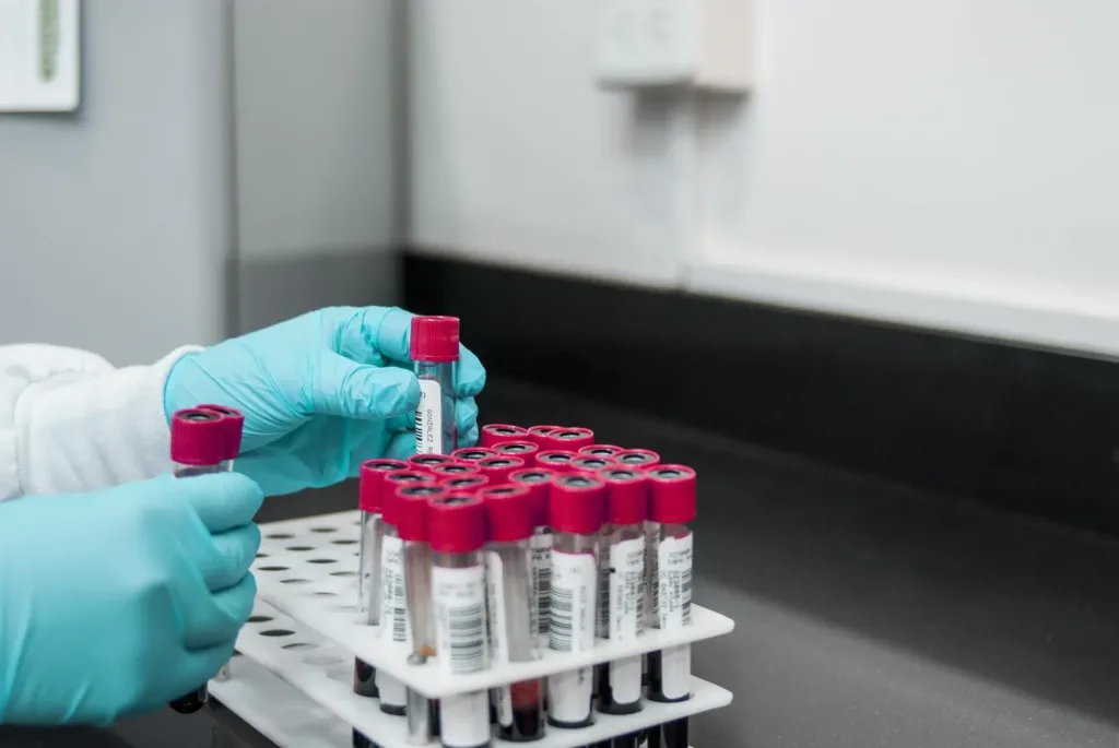 Reguläres Angebot ab 2027: Gratis STI-Tests